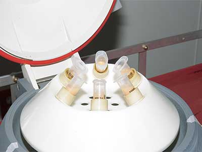 centrifugation-graisse