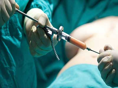 injection-graisse-seins