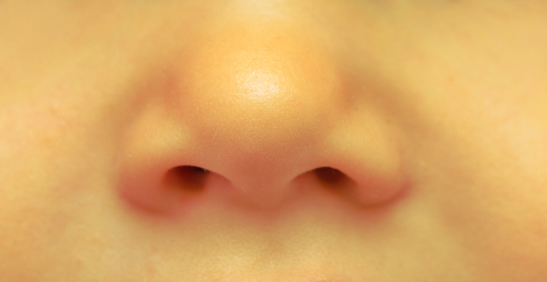Rhinoplastie fonctionnelle ou rhinoplastie esthétique ? Différentes techniques ?