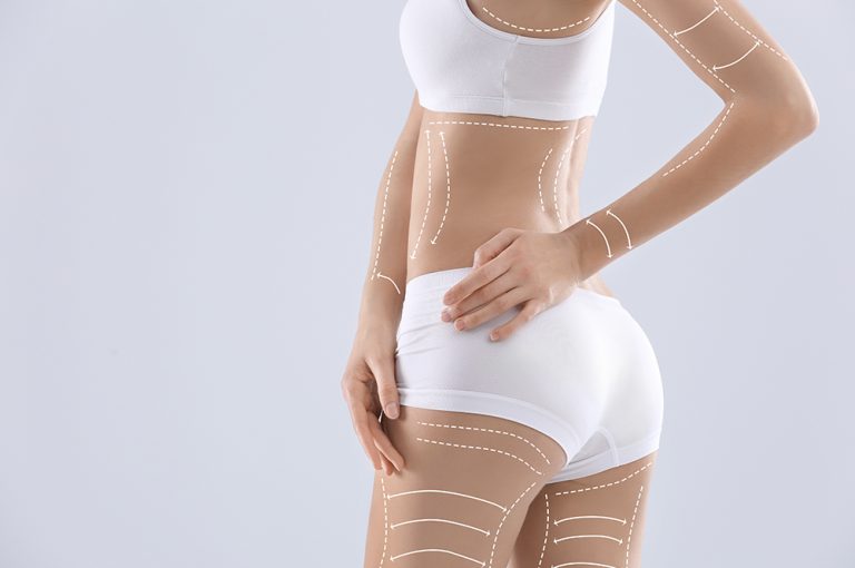 BodyTransformez votre corps après perte de poids