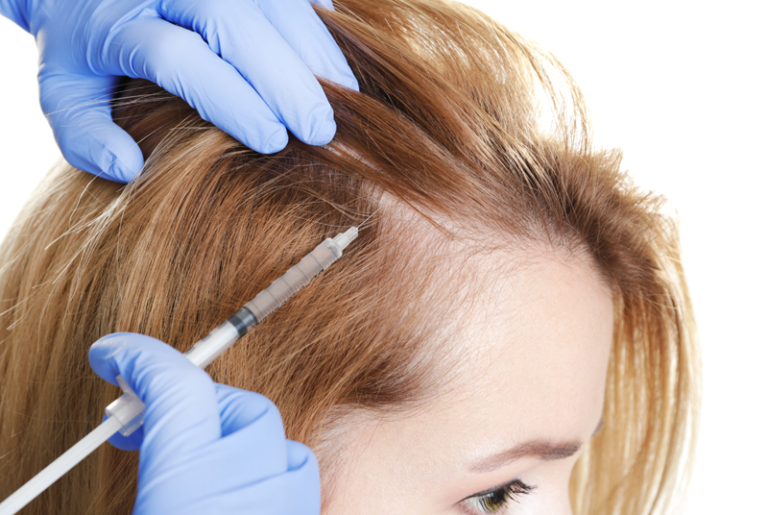 Mésothérapie cheveux en Tunisie : tout savoir !