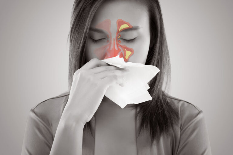 Hypertrophie des cornets nasaux : causes, symptômes et traitements